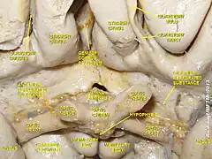 Cerebro. Vista inferior.Disección profunda