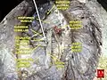Arteria glútea superior en una disección.