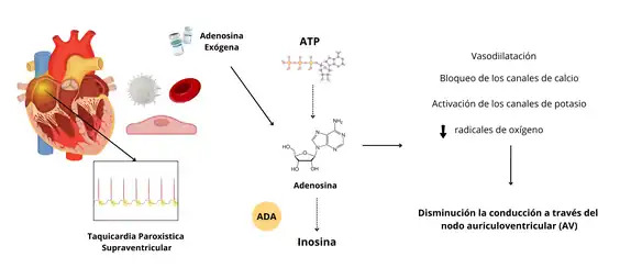 La imagen representa el mecanismo de acción de la adenosina exógena en el tratamiento de la taquicardia paroxística supraventricular (TPSV).  La adenosina es una molécula que se encuentra de forma natural en nuestro organismo, pero también puede ser administrada como medicamento. En esta imagen, se representa como una molécula simple y se indica que es exógena, es decir, que proviene de una fuente externa al cuerpo.  El ATP (trifosfato de adenosina), por otro lado, es una molécula que proporciona energía a las células. En la imagen se muestra su estructura molecular, más compleja que la de la adenosina.  Cuando se administra adenosina exógena:  Se une a los receptores de adenosina en las células del corazón. Esto desencadena una serie de eventos que conducen a la disminución de la conducción eléctrica a través del nodo auriculoventricular (NAV). Bloquea los canales de calcio: Al bloquear estos canales, se reduce la entrada de calcio a las células del corazón, lo que disminuye la fuerza y la frecuencia de las contracciones cardíacas. Activa los canales de potasio: Al activar estos canales, se aumenta la salida de potasio de las células del corazón, lo que también contribuye a disminuir la excitabilidad y la contractilidad del músculo cardíaco. Aumenta la producción de radicales de oxígeno: Aunque los radicales de oxígeno son generalmente dañinos para las células, en este caso, su producción tiene un efecto beneficioso al contribuir a la disminución de la conducción a través del NAV. Todos estos efectos combinados tienen como resultado la disminución de la conducción eléctrica a través del nodo auriculoventricular (NAV). El NAV es una estructura del corazón que controla la frecuencia cardíaca y la coordinación de las contracciones de las aurículas y los ventrículos. Al disminuir la conducción a través del NAV, la adenosina puede interrumpir los circuitos eléctricos anormales que causan la taquicardia paroxística supraventricular y restaurar un ritmo cardíaco normal.  La enzima ADA (adenosina desaminasa) es responsable de descomponer la adenosina en inosina. Esta es la razón por la cual el efecto de la adenosina es de corta duración, ya que rápidamente es metabolizada por esta enzima.