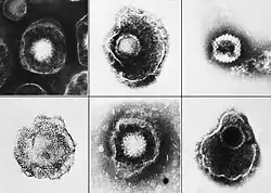 Virus