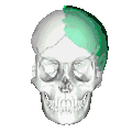 Animación 3D que muestra interna y externamente la posición del hueso parietal (en color verde).