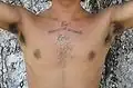 CS – Vello pectoral principalmente en el esternón y alrededor de los pezones