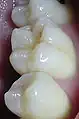 Plexodoncia (bunodonto)