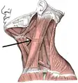 Músculo esternocleidomastoideo