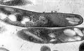M. tuberculosis