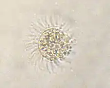 Myrionecta rubra (Cyclotrichida)