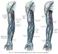 Las variaciones más frecuentes de las venas del antebrazo (esquema).