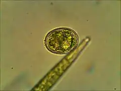 Quiste de Trachelomonas (Euglenozoa)