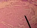 Corte transversal del músculo vocalis.