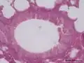 Bronquiolo de ratón visto al microscopio
