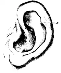 Human ear