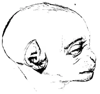 Fœtus of an Orang