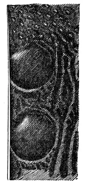 Descent of Man - Burt 1874 - Fig 60b.png