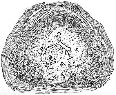 EB1911 Reproductive System, in Anatomy - prostate section.jpg