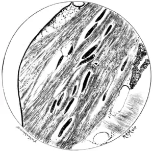 Tropical Diseases - Fig 103.png