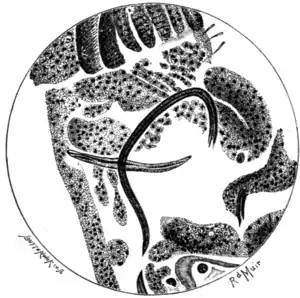 Tropical Diseases - Fig 106.png