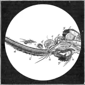 Tropical Diseases - Fig 107.png