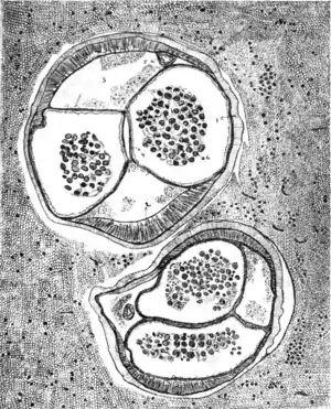 Tropical Diseases - Fig 109.png
