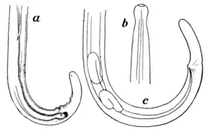 Tropical Diseases - Fig 111.png