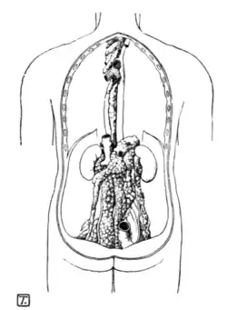Tropical Diseases - Fig 114.png