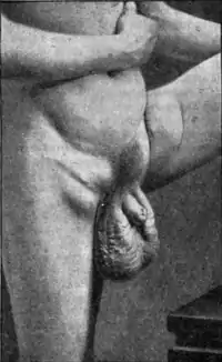 Tropical Diseases - Fig 117.png