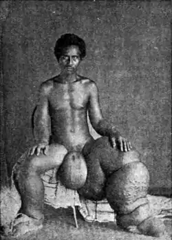 Tropical Diseases - Fig 119.png