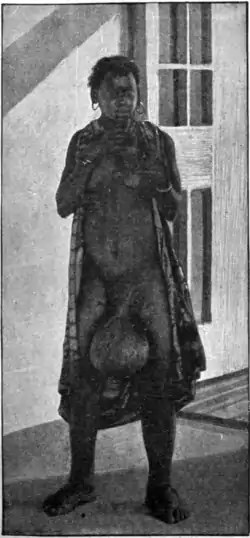 Tropical Diseases - Fig 124.png