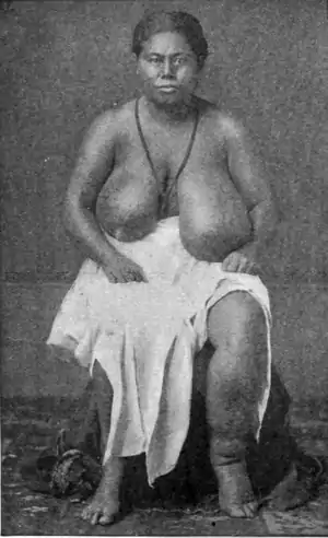 Tropical Diseases - Fig 125.png