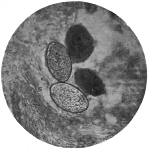Tropical Diseases - Fig 145.png