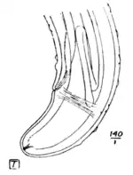 Tropical Diseases - Fig 156.png