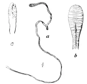 Tropical Diseases - Fig 159.png