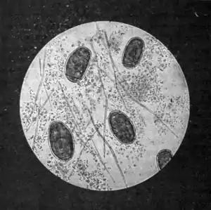 Tropical Diseases - Fig 161.png