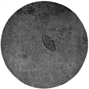 Tropical Diseases - Fig 170.png