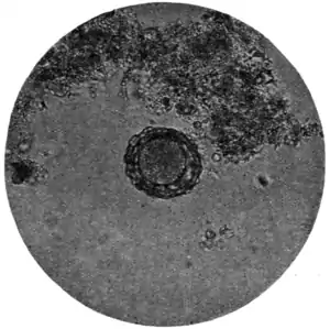 Tropical Diseases - Fig 171.png