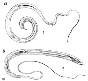 Tropical Diseases - Fig 174.png