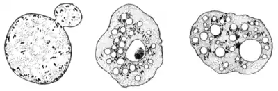 Tropical Diseases - Fig 18.png