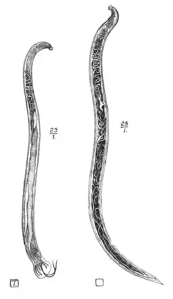 Tropical Diseases - Fig 181.png