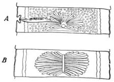 Tropical Diseases - Fig 198.png