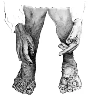 Tropical Diseases - Fig 211.png