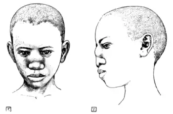 Tropical Diseases - Fig 222.png