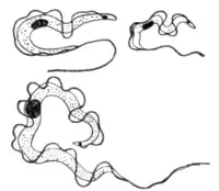 Tropical Diseases - Fig 229.png