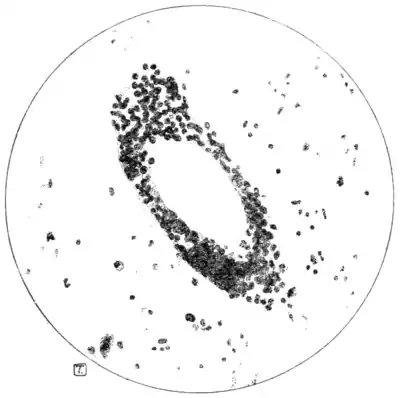 Tropical Diseases - Fig 49.png
