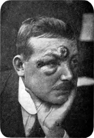 Tropical Diseases - Fig 58.png