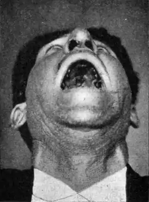 Tropical Diseases - Fig 59.png