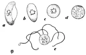 Tropical Diseases - Fig 7.png