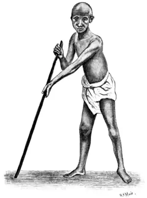 Tropical Diseases - Fig 75.png