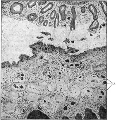 Tropical Diseases - Fig 81.png