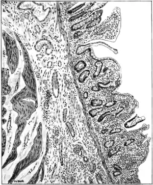 Tropical Diseases - Fig 83.png