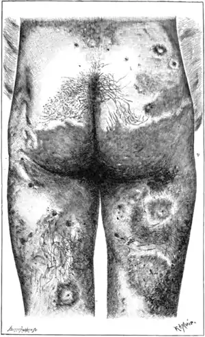 Tropical Diseases - Fig 86.png