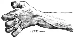 Tropical Diseases - Fig 87.png